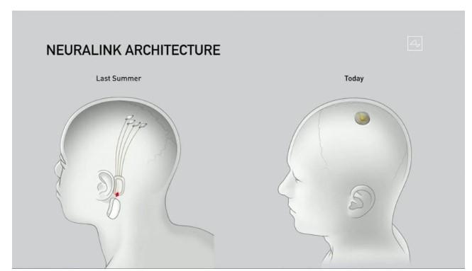 Future Pathways: Harnessing Neuralink for Enhanced Human Potential
