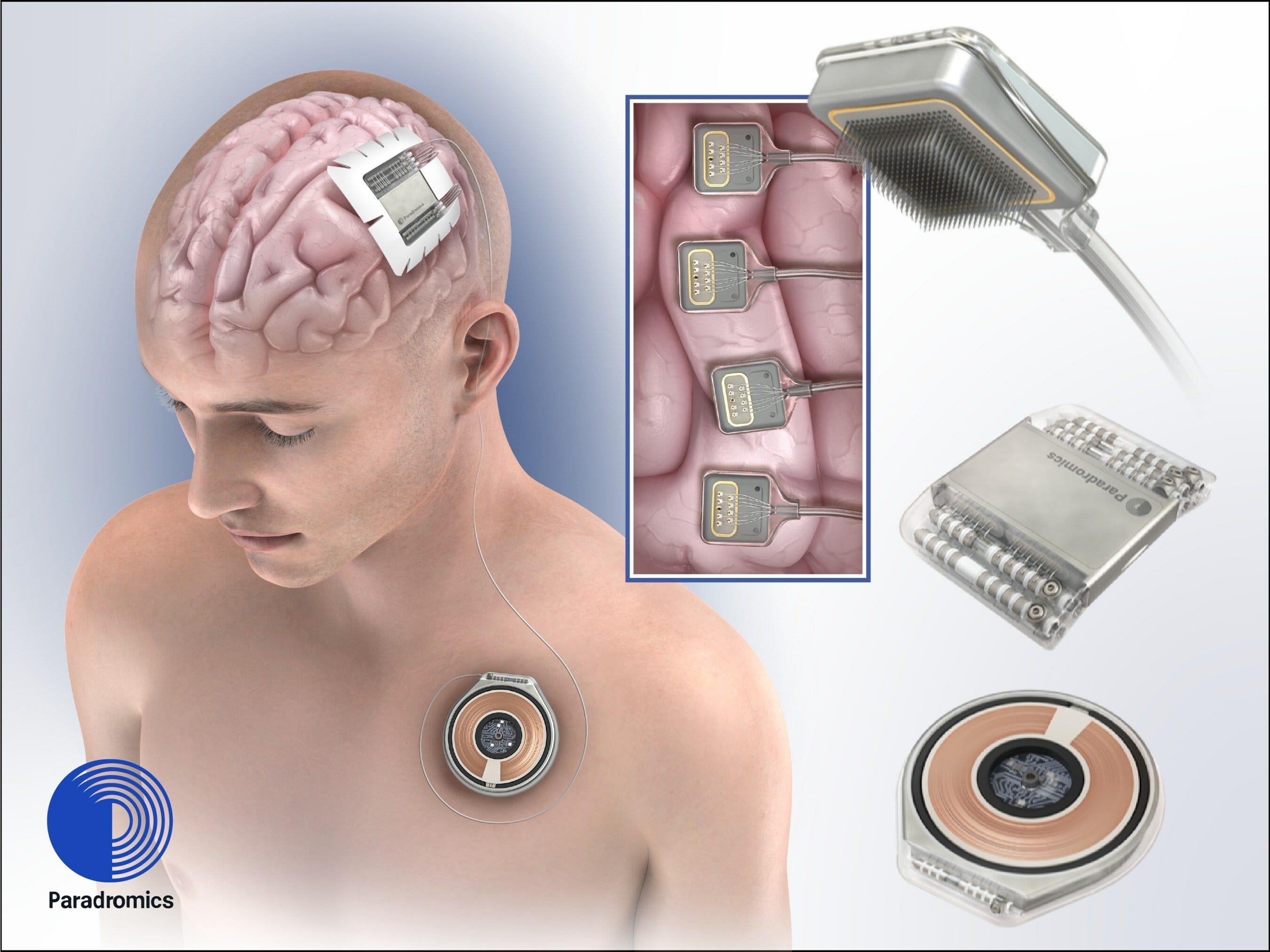Ethical Considerations and Societal Impacts of Brain-Machine Interfaces