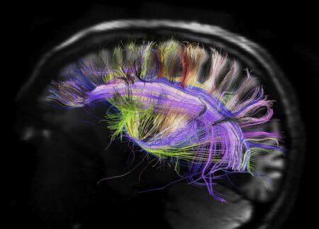 Brain imaging reveals major structural changes whose impact is not yet known. – Psychology Today