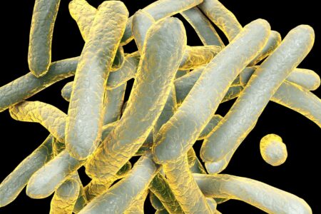 Leicester’s rate of TB almost four times higher than the English average – Leicester Mercury