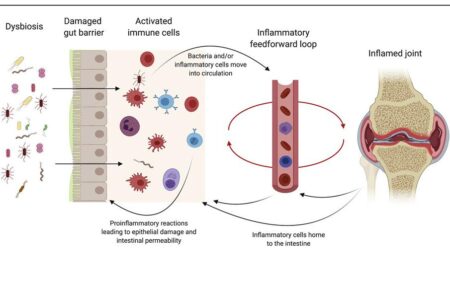 Gut health signals could transform arthritis treatment – University of Leeds