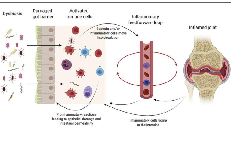 Gut health signals could transform arthritis treatment – University of Leeds
