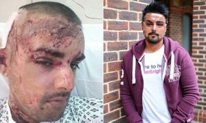 Man sustains facial injuries after attack in Crawley – SussexWorld