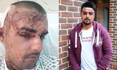 Man sustains facial injuries after attack in Crawley – SussexWorld