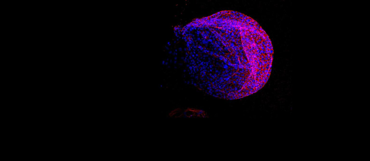 University of Oxford discovery could transform cancer screening – Yahoo News UK