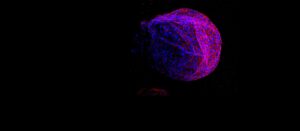 University of Oxford discovery could transform cancer screening – Yahoo News UK