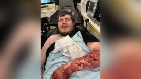 Stoke-on-Trent dog attack leaves woman with ‘serious’ injuries – Yahoo News UK