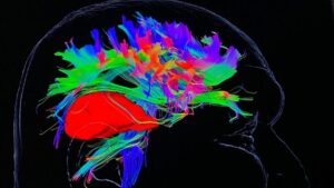 Oxford hospital uses UK-first tech used for brain tumour patients – BBC