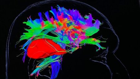 Oxford hospital uses UK-first tech used for brain tumour patients – BBC