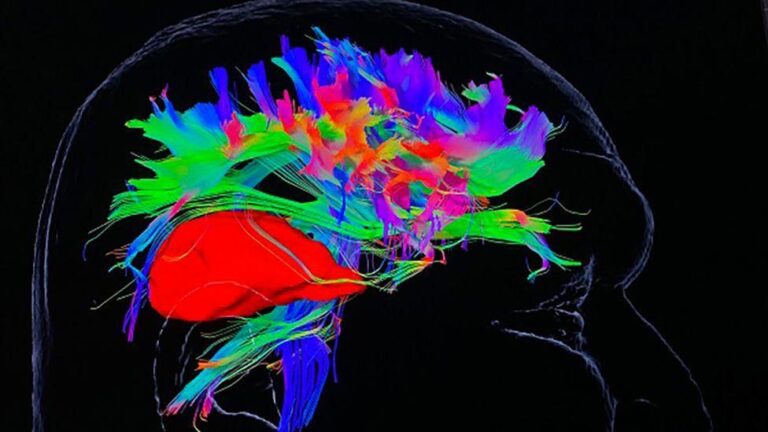 Oxford hospital uses UK-first tech used for brain tumour patients – BBC