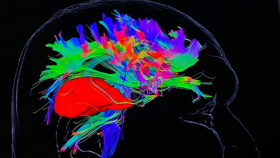 Oxford hospital uses UK-first tech used for brain tumour patients – BBC