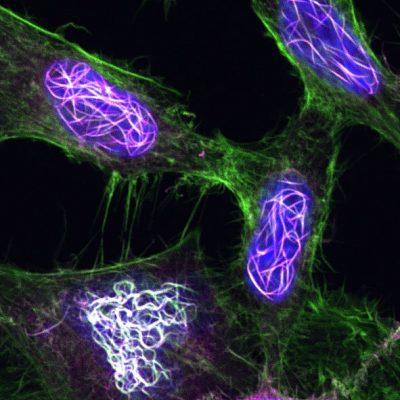 Cancer Research UK in Plymouth to close after 35 years – BBC
