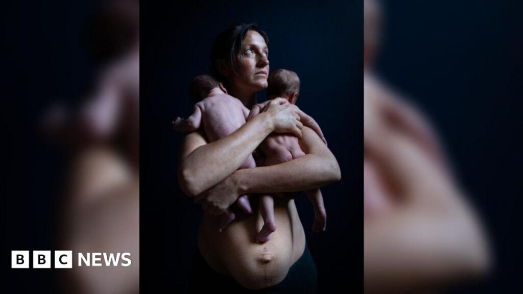 ‘Pregnant women and babies evacuated’ after fire at Bristol maternity hospital – Sky News