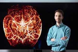 UK economy losing billions to cancer – University of Leeds