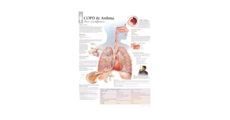 Let’s Talk – Asthma, COPD and Diabetes – Age UK