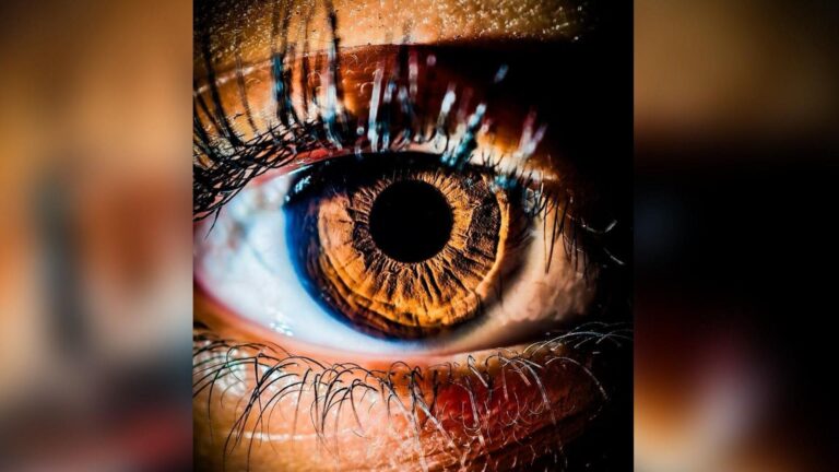 Bradford teen with bandaged hand goes missing – live updates – Yorkshire Live